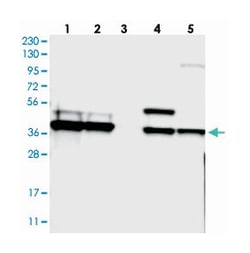 CCDC51 Rabbit anti-Human, Mouse, Rat, Polyclonal Antibody, Abnova 100 &mu;L | Buy Online | Abnova | Fisher Scientific