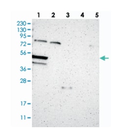 TNRC4, Rabbit, Polyclonal Antibody, Abnova 100&mu;L; Unlabeled:Antibodies,
