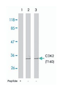 CDK2 (phospho T160), Rabbit anti-Human, Mouse, Rat, Polyclonal Antibody, Abnova 100 &mu;g | Buy Online | Abnova | Fisher Scientific