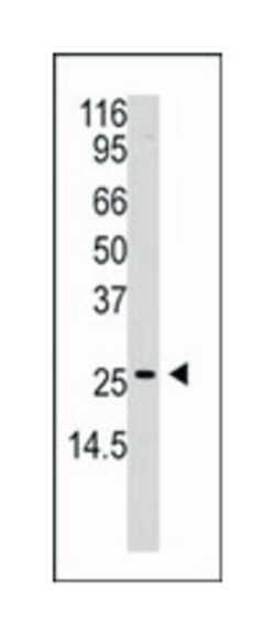 APH1A Rabbit anti-Human, Polyclonal Antibody, Abnova 400&mu;L; Unlabeled:Antikörper