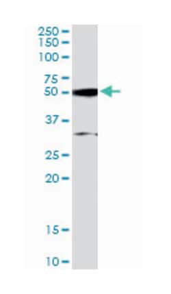 ATF2, Goat, Polyclonal Antibody, Abnova 100 &mu;g | Buy Online | Abnova Corporation | Fisher Scientific
