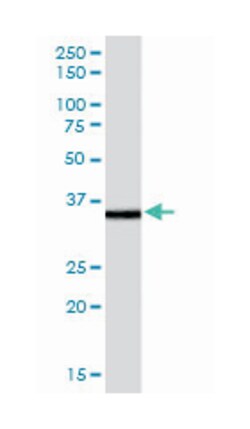 MRPL3, Goat, Polyclonal Antibody, Abnova 100 &mu;g | Buy Online | Abnova Corporation | Fisher Scientific