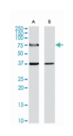 ACOX2, Goat, Polyclonal Antibody, Abnova 100 &mu;g | Buy Online | Abnova Corporation | Fisher Scientific