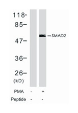 SMAD2 (phospho S467), Rabbit anti-Human, Mouse, Rat, Polyclonal Antibody,