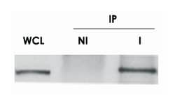ch-TOG, Rabbit, Polyclonal Antibody, Abnova 100 &mu;L | Buy Online | Abnova Corporation | Fisher Scientific