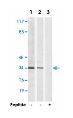 NKX6-3 Rabbit anti-Human, Mouse, Polyclonal Antibody, Abnova 100 &mu;g | Buy Online | Abnova Corporation | Fisher Scientific