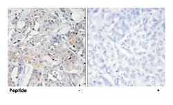 COL6A3, Rabbit, Polyclonal Antibody, Abnova 100&mu;g; Unlabeled:Antibodies,