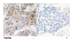 COX7A2P2, Rabbit, Polyclonal Antibody, Abnova 100&mu;g; Unlabeled:Antibodies,