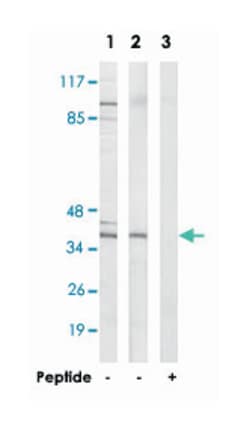 MRPL39, Rabbit, Polyclonal Antibody, Abnova 100&mu;g; Unlabeled:Antibodies,