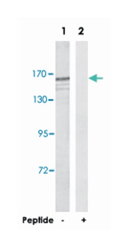 NBEAL1, Rabbit, Polyclonal Antibody, Abnova 100 &mu;g | Buy Online | Abnova | Fisher Scientific