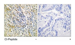 ACAN Rabbit anti-Human, Rat, Polyclonal Antibody, Abnova 100&mu;g; Unlabeled:Antibodies,