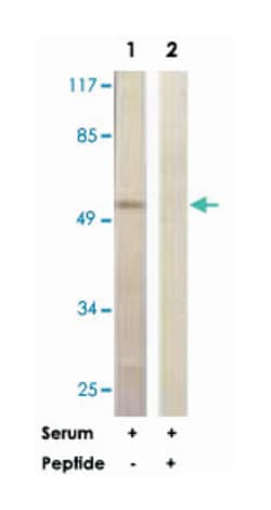 AKT1 Rabbit anti-Human, Mouse, Rat, Polyclonal Antibody, Abnova 100 &mu;g | Buy Online | Abnova | Fisher Scientific