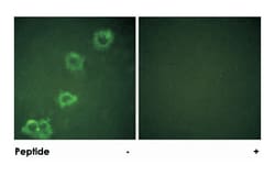 BACE1 Rabbit anti-Human, Mouse, Rat, Polyclonal Antibody, Abnova 100&mu;g;