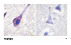BID Rabbit anti-Human, Mouse, Polyclonal Antibody, Abnova 100&mu;g; Unlabeled:Antibodies,