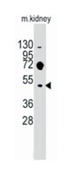 Evx2, Rabbit, Polyclonal Antibody, Abnova 400 &mu;L | Buy Online | Abnova Corporation | Fisher Scientific