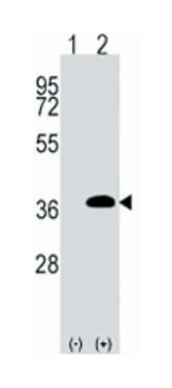 FRAT1 Rabbit anti-Human, Polyclonal Antibody, Abnova 400 &mu;L | Buy Online | Abnova Corporation | Fisher Scientific