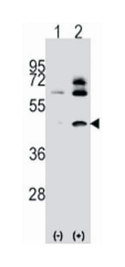 ACTB/ACTC1 Rabbit anti-Human, Polyclonal Antibody, Abnova 400 &mu;L | Buy Online | Abnova Corporation | Fisher Scientific