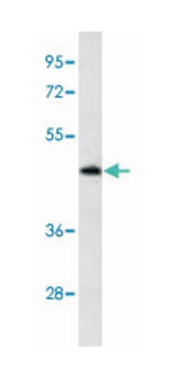 ILK Rabbit anti-Human, Polyclonal Antibody, Abnova 400 &mu;L | Buy Online | Abnova Corporation | Fisher Scientific