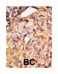 TLR6 Rabbit anti-Human, Mouse, Polyclonal Antibody, Abnova 400&mu;L; Unlabeled:Antibodies,