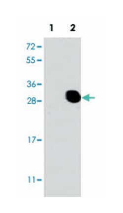 BGLAP, Rabbit, Polyclonal Antibody, Abnova 400&mu;L; Unlabeled:Antibodies,