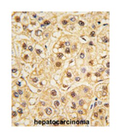 YWHAZ Rabbit anti-Human, Polyclonal Antibody, Abnova 400&mu;L; Unlabeled:Antibodies,