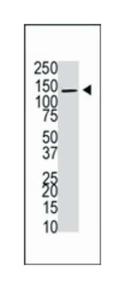 USP8 Rabbit anti-Human, Polyclonal Antibody, Abnova 400 &mu;L | Buy Online | Abnova Corporation | Fisher Scientific