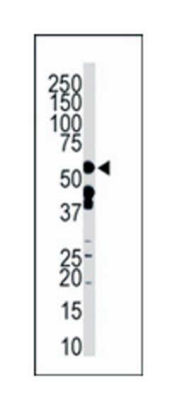 ZMPSTE24 Rabbit anti-Human, Polyclonal Antibody, Abnova 400&mu;L; Unlabeled:Antibodies,