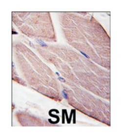 PDK4 Rabbit anti-Human, Polyclonal Antibody, Abnova 400 &mu;L | Buy Online | Abnova Corporation | Fisher Scientific