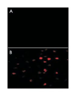 PKM2 Rabbit anti-Human, Monkey, Mouse, Rat, Polyclonal Antibody, Abnova 400 &mu;L | Buy Online | Abnova Corporation | Fisher Scientific