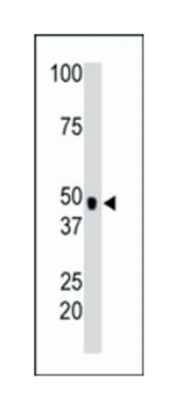 CHKA Rabbit anti-Human, Mouse, Polyclonal Antibody, Abnova 400 &mu;L | Buy Online | Abnova Corporation | Fisher Scientific