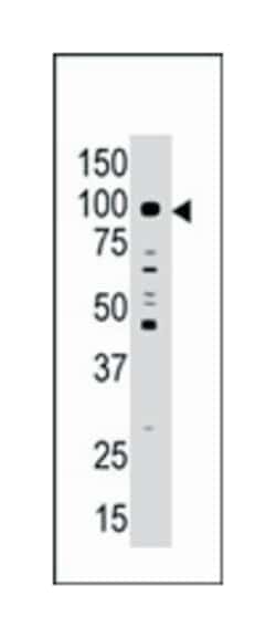 MAGED1, Rabbit, Polyclonal Antibody, Abnova 400 &mu;L | Buy Online | Abnova Corporation | Fisher Scientific