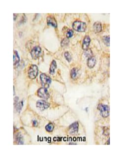 CD14 Rabbit anti-Human, Polyclonal Antibody, Abnova 400&mu;L; Unlabeled:Antibodies,