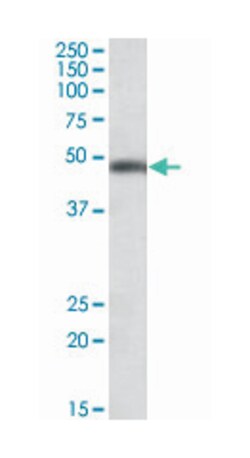 SEC61A1, Goat, Polyclonal Antibody, Abnova 100 &mu;g | Buy Online | Abnova Corporation | Fisher Scientific