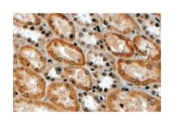 RNF34 Goat anti-Human, Polyclonal Antibody, Abnova 100 &mu;g | Buy Online | Abnova Corporation | Fisher Scientific