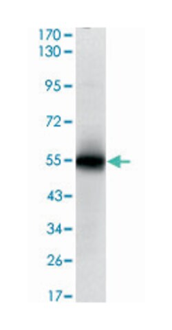 MSI1, Mouse, Clone: 2A12, Abnova 100&mu;L; Unlabeled:Antibodies, Monoclonal