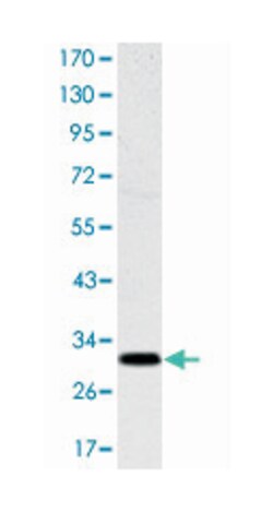 MSX1, Mouse, Clone: 5D11, Abnova 100&mu;L; Unlabeled:Antibodies, Monoclonal