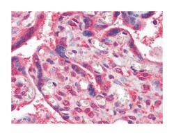 NME1, Mouse, Clone: 4B2, Abnova 100&mu;L; Unlabeled:Antibodies, Monoclonal