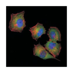 NME1, Mouse, Clone: 4B2, Abnova 100&mu;L; Unlabeled:Antibodies, Monoclonal