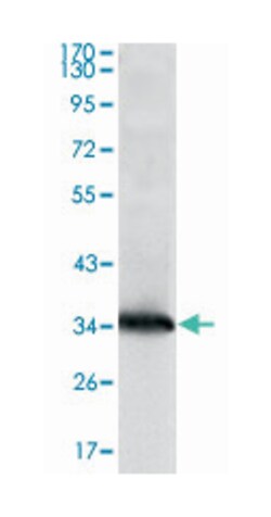 NME1, Mouse, Clone: 4B2, Abnova 100&mu;L; Unlabeled:Antibodies, Monoclonal