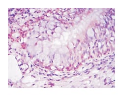NR3C1, Mouse, Clone: 6E6, Abnova 100&mu;L; Unlabeled:Antibodies, Monoclonal