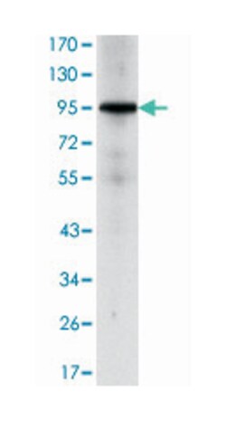 NR3C1, Mouse, Clone: 6E6, Abnova 100&mu;L; Unlabeled:Antibodies, Monoclonal