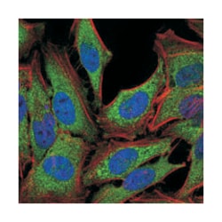 NR3C1, Mouse, Clone: 6E6, Abnova 100&mu;L; Unlabeled:Antibodies, Monoclonal