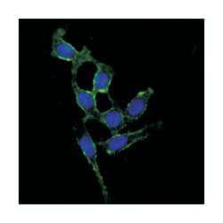 PTK2, Mouse, Clone: 10H7E9, Abnova 100 &mu;L | Buy Online | Abnova | Fisher Scientific