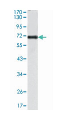 PTK2, Mouse, Clone: 10H7E9, Abnova 100 &mu;L | Buy Online | Abnova | Fisher Scientific