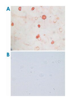 KSHV K8, Mouse, Clone: 8C12G10G1, Abnova 100&mu;L; Unlabeled:Antibodies,
