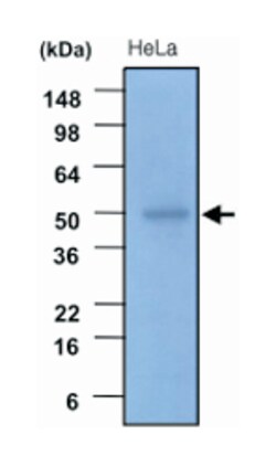 GSK3B, Mouse, Clone: 1F7, Abnova 100 &mu;L | Buy Online | Abnova Corporation | Fisher Scientific