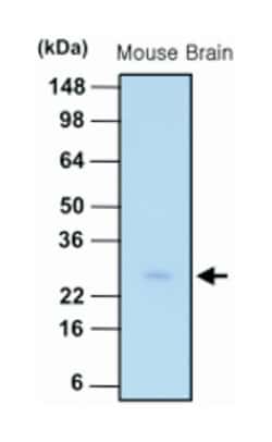 PSPH, Mouse, Clone: 3G12, Abnova 100&mu;L; Unlabeled:Antibodies, Monoclonal