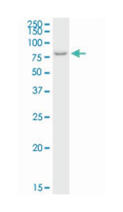 HSPA1A, Mouse, Clone: 4E7, Abnova 100&mu;L; Unlabeled:Antibodies, Monoclonal