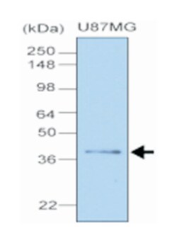 CLU, Mouse, Clone: 1A11, Abnova 100&mu;L; Unlabeled:Antibodies, Monoclonal