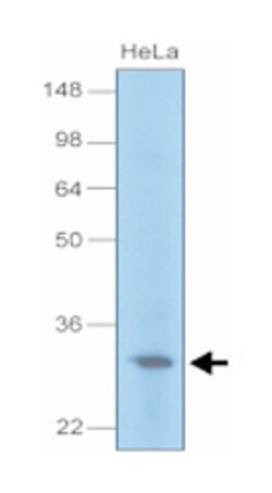 UNG, Mouse, Clone: k1C12, Abnova 100&mu;L; Unlabeled:Antibodies, Monoclonal